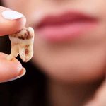 Răng số mấy? Giải mã giấc mơ thấy răng và con số may mắn dễ trúng