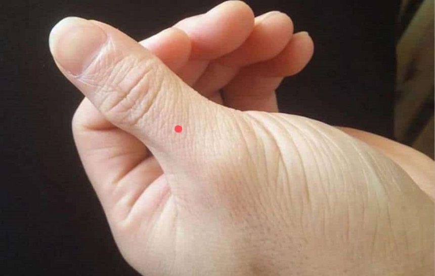 Nốt ruồi trên ngón tay cái màu đỏ